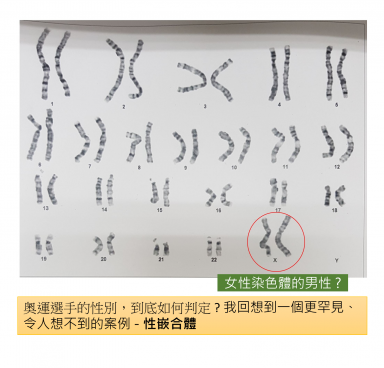 性嵌合體,陰陽人,性別判定