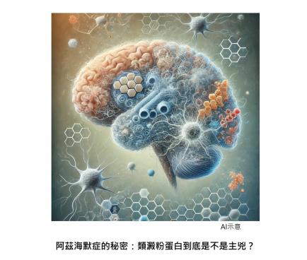 阿茲海默症的秘密：類澱粉蛋白到底是不是主兇？