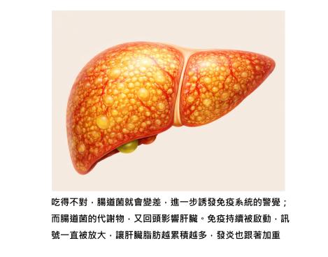 脂肪肝,是身體在「慢慢失去平衡」的訊息