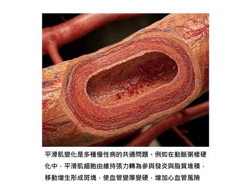 血管硬化、氣喘、腸胃不順,背後可能是同一個關鍵:平滑肌細胞